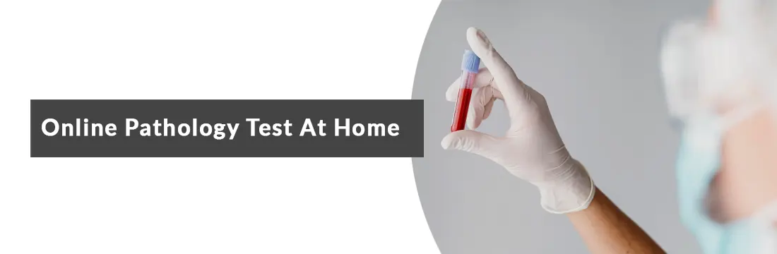 How to Choose Best Online Pathology Test at Home
